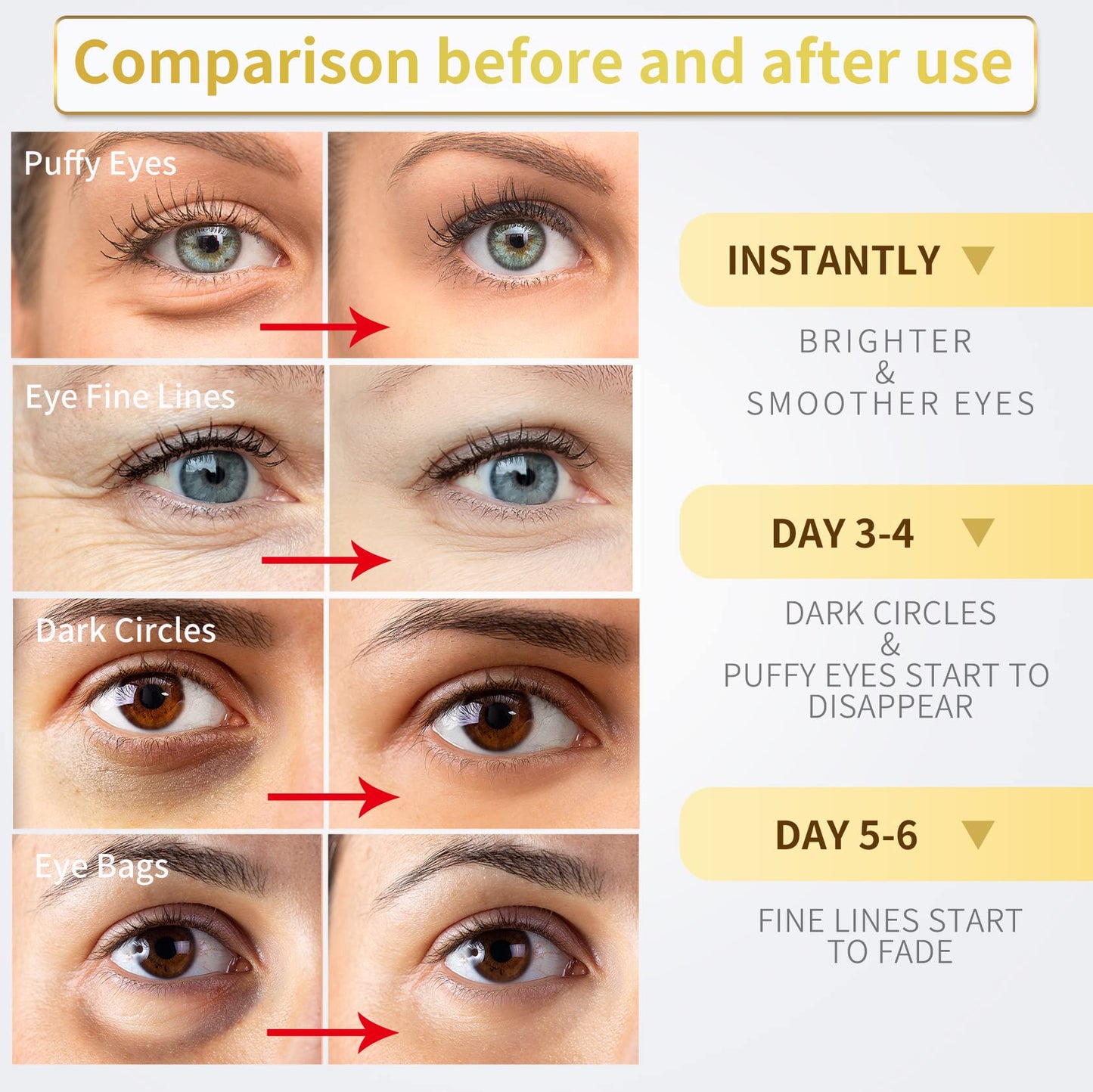 NAZANO 24K Gold Under Eye Patches - 60 Pack for Puffy Eyes, Dark Circles, Bags & Wrinkles with Collagen & Hyaluronic Acid