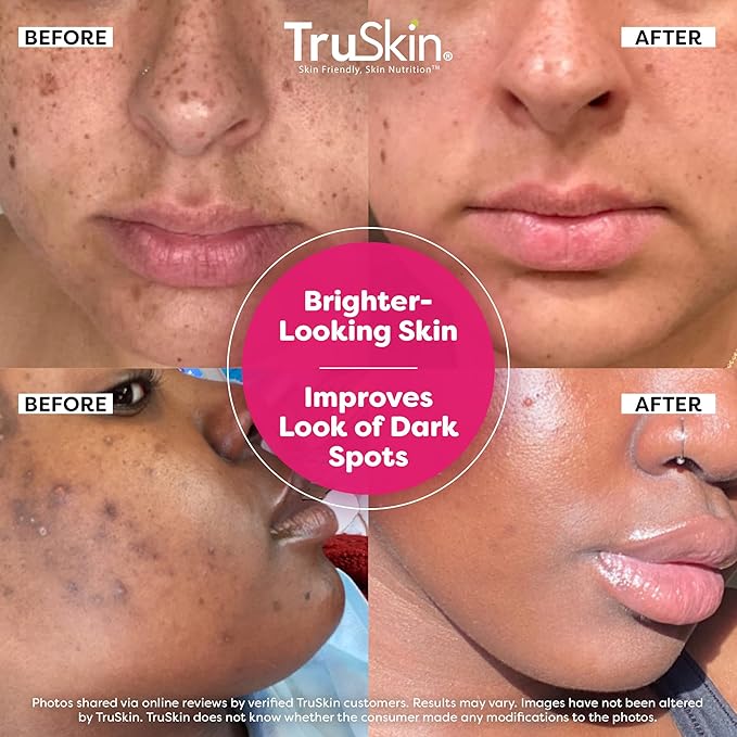 TruSkin Vitamin C Super Serum - Niacinamide, Retinol, Hyaluronic & Salicylic Acid - All-in-One Anti Aging Serum for Face β Improve Appearance of Dark Spots, Firmness for Brighter Looking Skin, 2 Fl Oz