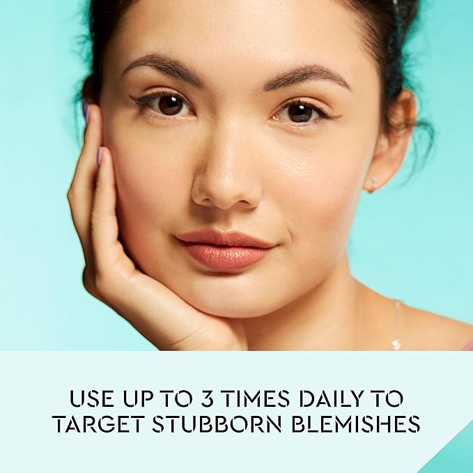 Bliss Clear Genius Acne Spot Treatment β Maximum Strength 2% Salicylic Acid Shrinks Blemishes β Clean, Vegan, Cruelty-Free, 0.5 Fl Oz