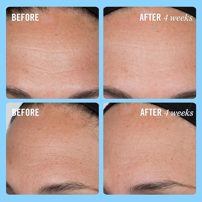 First Aid Beauty Firming Collagen Cream with Collagen, Peptides and Niacinamide β Day + Night Anti-Aging Face Moisturizer β 1.7 fl oz