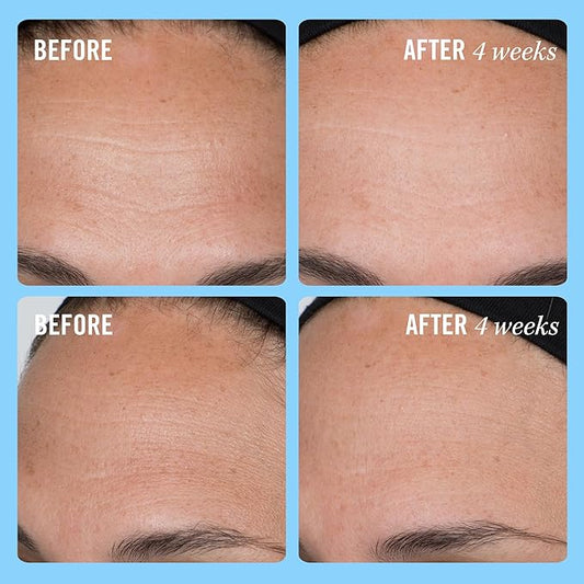 First Aid Beauty Firming Collagen Cream with Collagen, Peptides and Niacinamide β Day + Night Anti-Aging Face Moisturizer β 1.7 fl oz