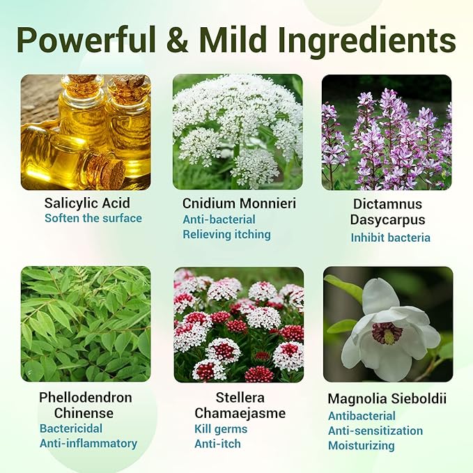 Psoriasis Cream, Maximum Strength Treatment Moisturizing Cream for Psoriasis, Dermatitis, Rash, Anti-Itch, Redness, Flaking, Scaling, Fast Acting Relief for Irritated, Dry Skin