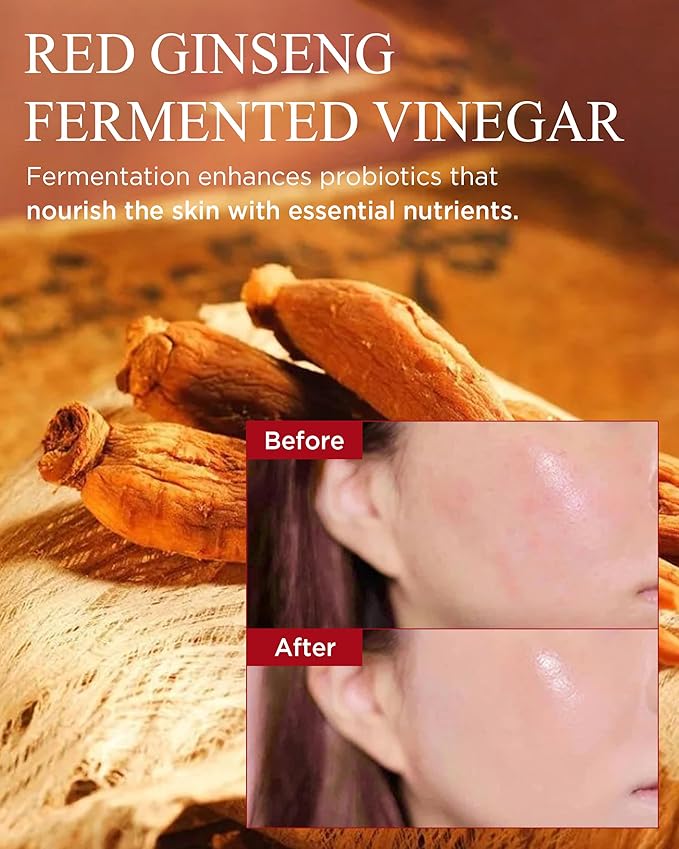 Bonyongo Red Ginseng Vinegar Essenceβ Revitalizing & Intensive Nourishing for All Skin Types - Hydrated and Glowing Skin with Fermented Red Ginseng - Korean Skincare, 1.5 fl.oz.