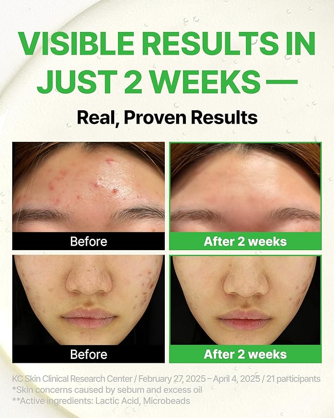 Trouble Control Pad | Korean Toner for Oily, Sensitive & Acne-Prone Skin โ Exfoliating Facial Pads with Dual Cotton Rounds & Calming Botanicals (70 Pads)