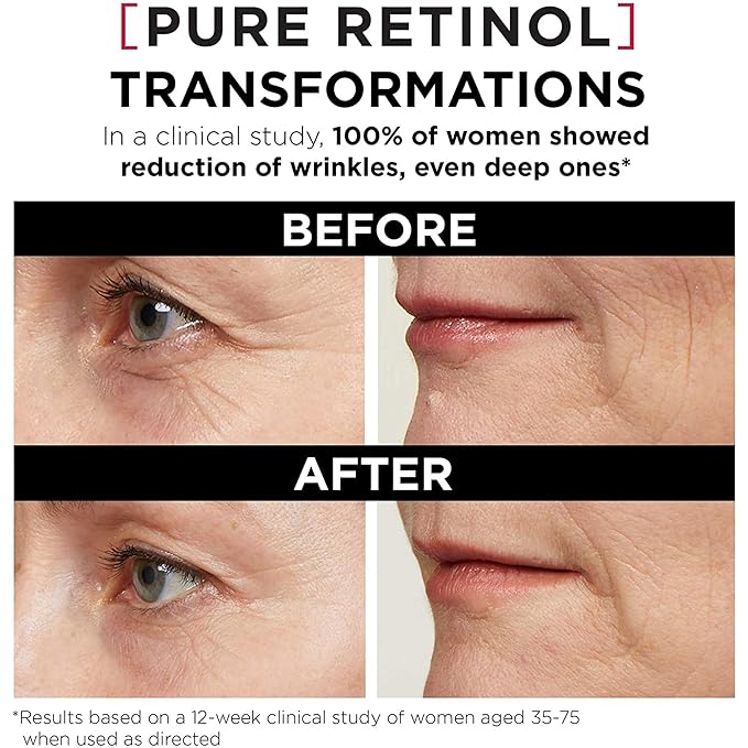 'L'Oreal Paris Revitalift Triple Power LZR Retinol Night Serum For Face, With 0.3% Pure Retinol, Moisturizes Skin and Eliminates Deep Wrinkles, For All Skin Types, 30ml