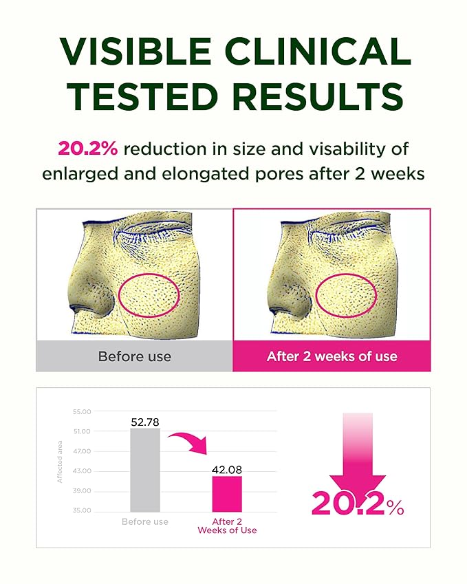 CKD Retino Collagen Boosting Hydrogel Face Mask (10ea) - Korean Firming Jelly Mask for Glass Skin, Pore Minimizing and Moisturizing with Retinal & Low Molecular Collagen. Korean Skin Care.