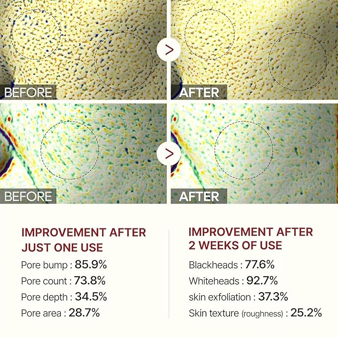 Black And White Rice Exfoliant Set, Facial Peels, 2PCS White + Black Rice exfoliator Peeling Ampoule, Soft Exfoliating Face and Body Scrub Dead Skin Cells Remover for All Skin Types Deep Hydration