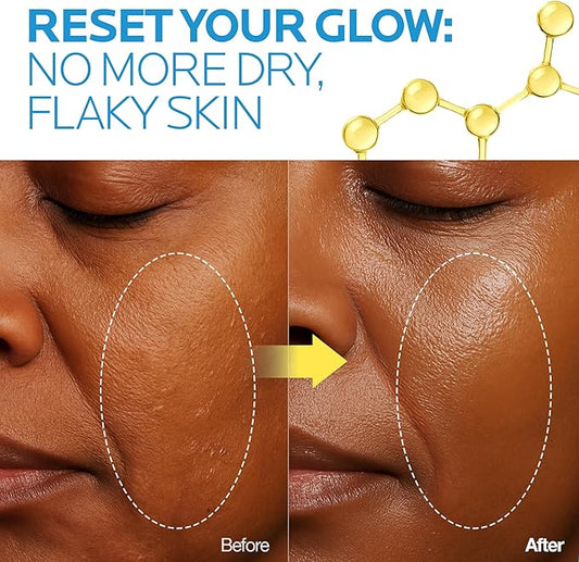 mimmua Glow Reset Toner | Korean Clinic Skincare - Thioctic Acid & Niacinamide 5% | Gentle Exfoliation w/Pumpkin Extract | Fades Melasma & Hyperpigmentation | Deep Hydration | 250ml / 8.45 Fl Oz