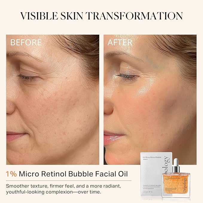 1% Retinol Face Oil with Firming, Smoothing & Glowingβ Retinol Serum for Face, Lightweight Squalane Facial Oil for Fine Lines, Texture & Anti-Aging, Gentle for All Skin 1.01 fl oz