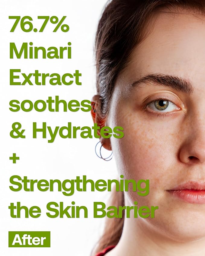 Calm-Clera Minari Calming Serum, Korean Spring Herb Facial Serum, Soothing and Calming for Sensitive Skin, Natural Skincare, Clean Beauty With Vitamin C, Korean Skin Care,1.52 Fl Oz