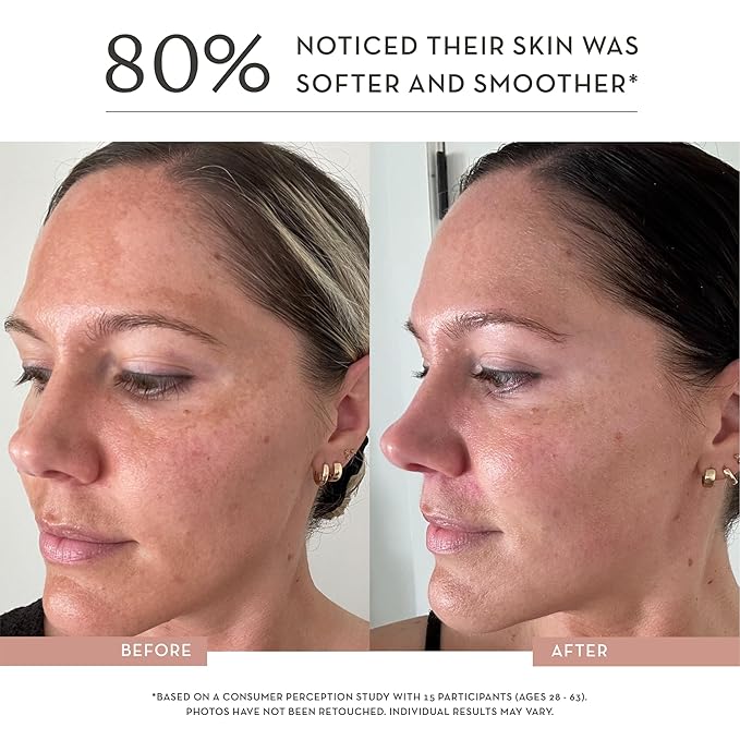 Dose of Glow Vitamin C Serum- Hydrating and Brightening Serum with Peptides, Hyaluronic Acid, Niacinamide and CoQ10. Firms Skin and Reduces Dark Spots and Fine Lines. 1 fl oz