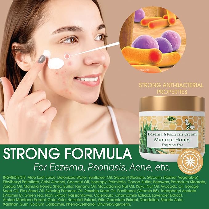 Green Leaf Naturals Manuka Honey Eczema Cream Moisturizing Lotion Fragrance Free for Psoriasis Relief - Itchy, Dry Skin Ointment - Skin Soothing Moisturizer - Body & Face Cream - Kids & Adults 4oz