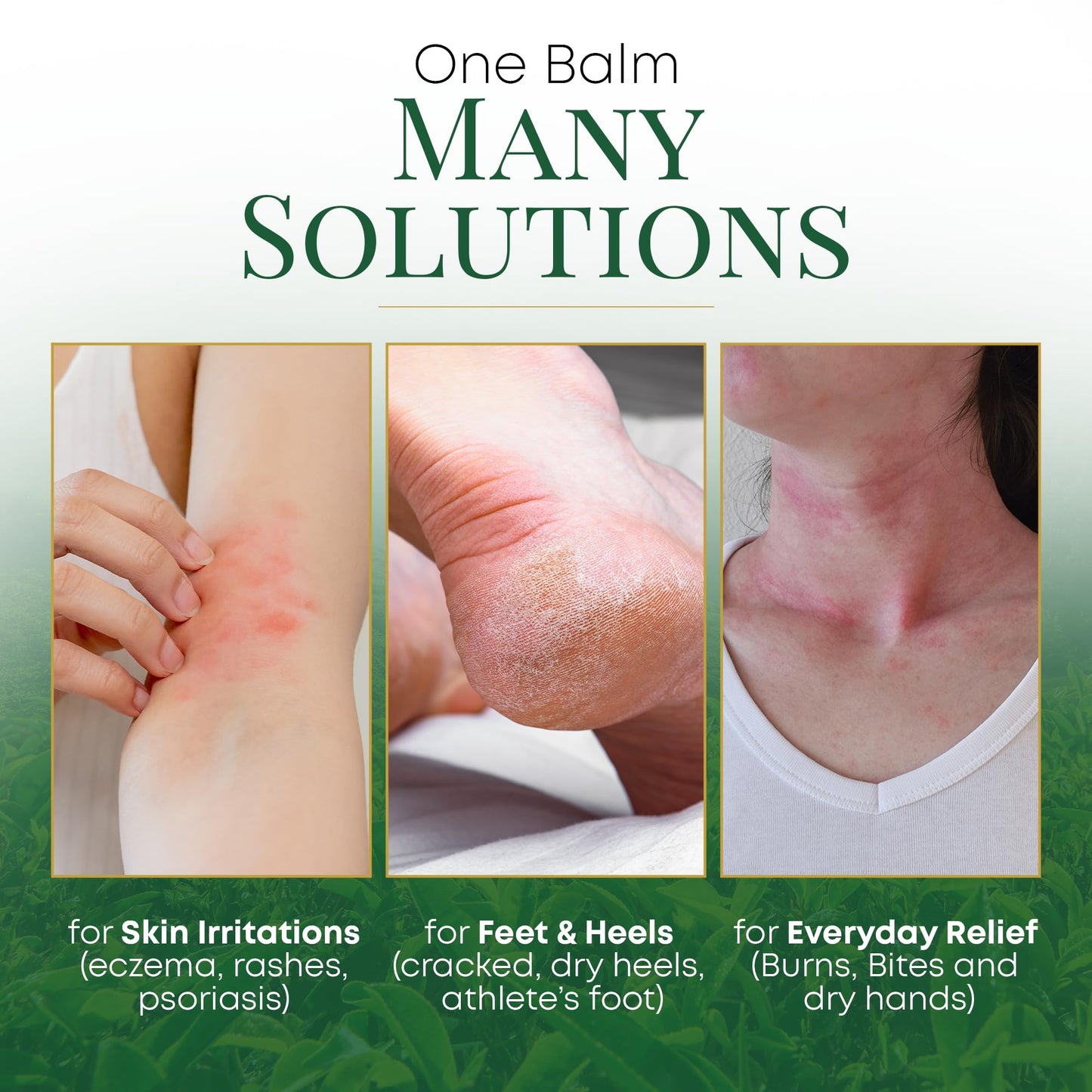 Chamuel Tea Tree Oil Balm - All Natural | Great Cream for Soothing Eczema, Psoriasis, Rashes, Jock Itch, Insect Bites, Folliculitis, Acne, Itches, Cracked Heels, Cuticles, Saddle Sores & more!