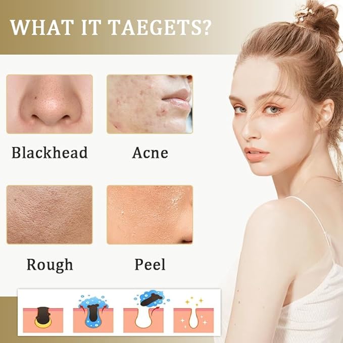 2PCS Rice Exfoliating Ampoule Set, 2025 Upgrade Black & White Rice Peeling Duo for Glowing Skin | Gentle Exfoliant + Pore Minimizing Serum + Deep Hydration & Hyaluronic Acid