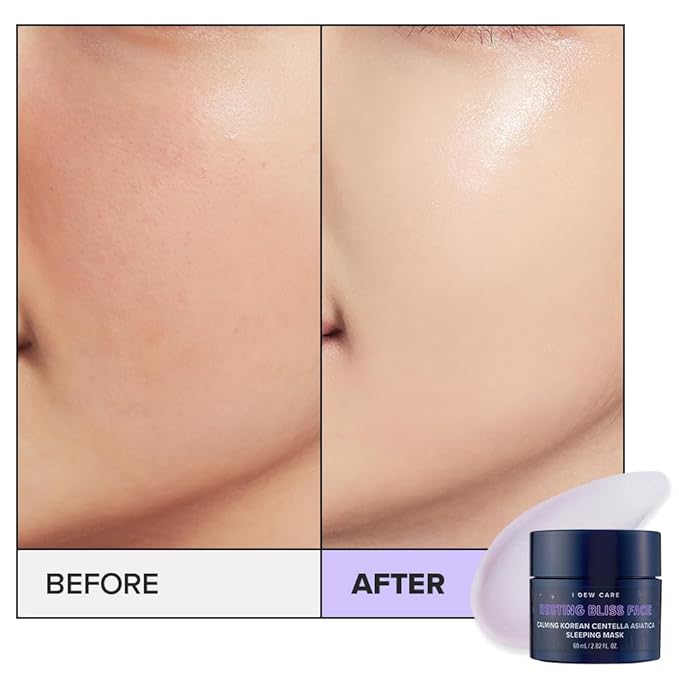 I DEW CARE Night Sleeping Mask - Resting Bliss Face | Calming Overnight Mask for Soothing & Balanced Skin, Korean Skincare for a Calm, Radiant Complexion, 2.02 FL Oz (60 ml)