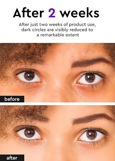 Bewants Under Eye Cream for Puffiness and Bags, Phyto Collagen Firming & Hydrating Treatment – 56.7% Vegan Collagen & Plant-Based Retinol, Refreshing Massage Applicator, 0.67 fl oz (2 Pack)