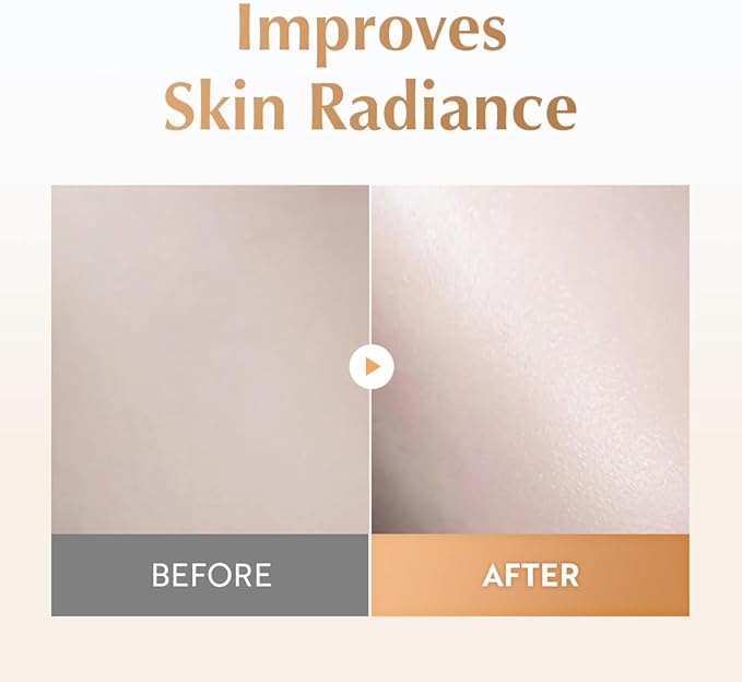 UIQ Biome Barrier Treatment Essence Nourishing, Hydrating, Moisturizing Toner l Korean Skincare for All Skin Types | Daily Gentle Dead Skin Cell Care I Glow Skin Radiance 5.07 fl.oz /150ml