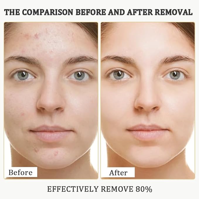 2PCS Rice Exfoliating Ampoule Set, 2025 Upgrade Black & White Rice Peeling Duo for Glowing Skin | Gentle Exfoliant + Pore Minimizing Serum + Deep Hydration & Hyaluronic Acid