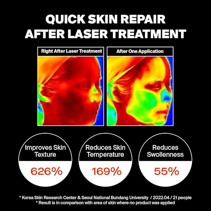 PIXCELL BIOM™ After Laser Rebooting Cream for Probiotic Barrier Recovery with Niacinamide, Panthenol, Suitable for Sensitive Skin, 1.69 fl oz(50ml)