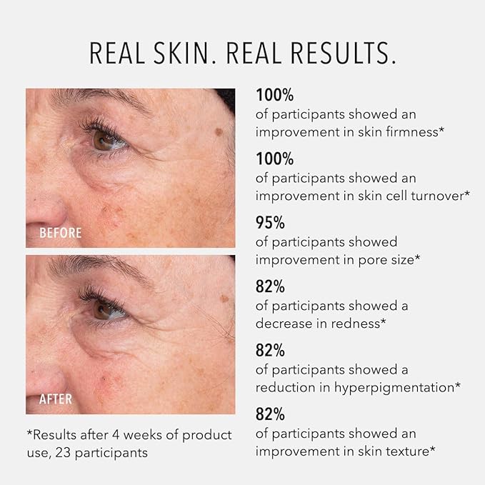 HydroPeptide Liquid Resurfacing Solution, Daily Leave-On Peptide Exfoliant with 2% Salicylic Acid, Exfoliate & Illuminate, 4 Ounce