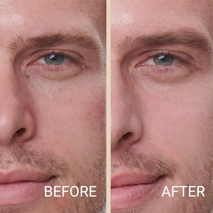 MATTR Skin Fix - Luxury - Easy for Men - Tinted Concealer - Visibly Covers Fine Lines, Under-Eye Bags, Razor Burns, Pimples - Vegan Makeup - Perfect for Gym Bag or Travel - 15g (F1)