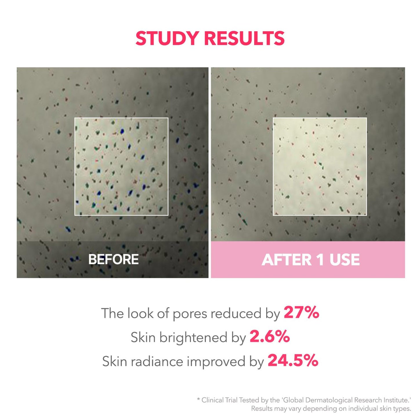 APRILSKIN TXA Niacinamide 99 Overnight Wrapping Mask | 99% High-Purity TXA+Niacinamide for Uneven Skin Tone | Overnight Skin Booster for Toning Care, Firming & Pore Care | 80ml, 2.70 fl.oz.