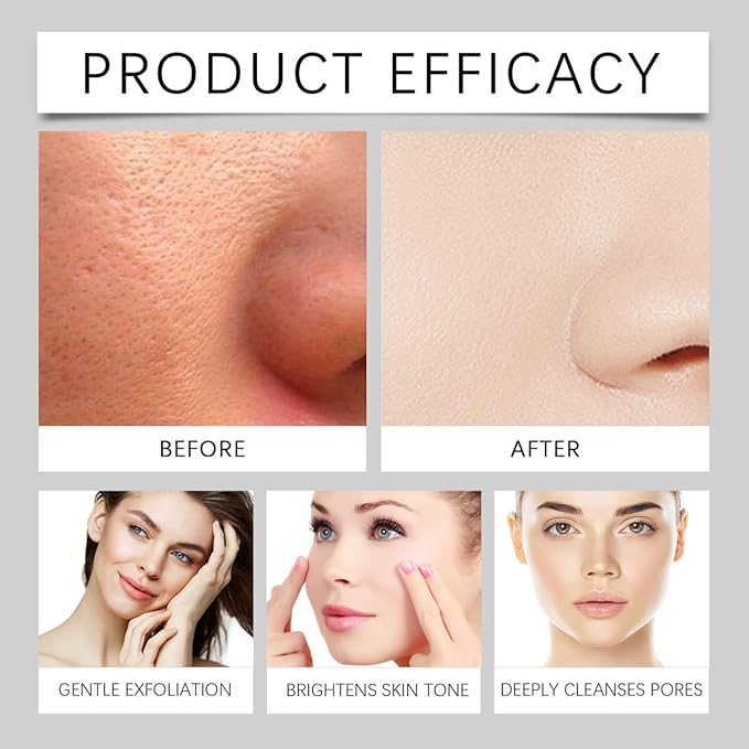 Black and White Rice Exfoliant, Premium Rice Ampoule Exfoliating Solution Face and Body Peeling Moisturizing for All Skin. (1Pcs White)