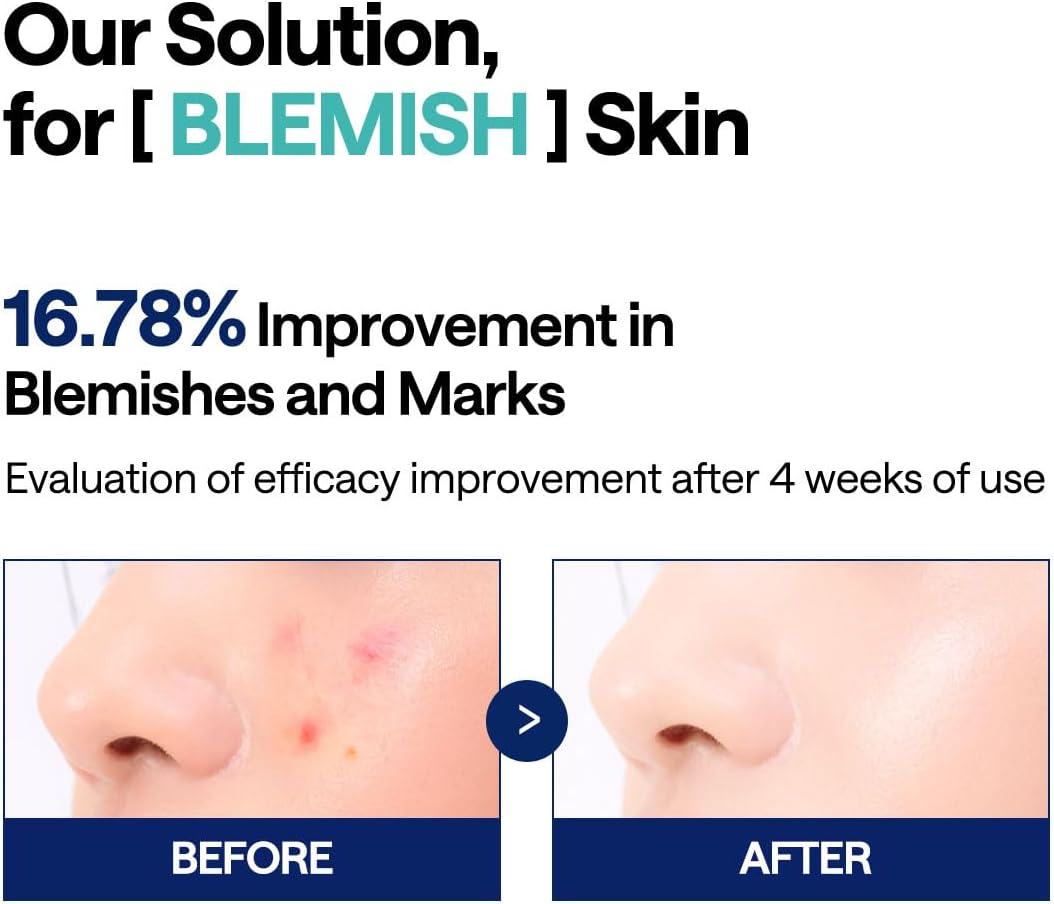 MEDIHEAL Madecassoside Toner Pads - with Centella Asiatica to Treat Blemishes and Improve Uneven Skin Tone - Vegan Gauze Fabric, 100 Pads