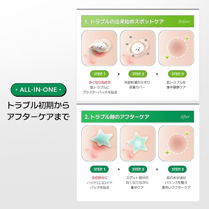 UIQ x RIIZE Biome Remedy Calming Spot Patch (96 count) with folder mirror, Hydrocolloid, Plasta patches for face & body, Cute designed patch, Non-comedogenic, Hypoallergenic tested