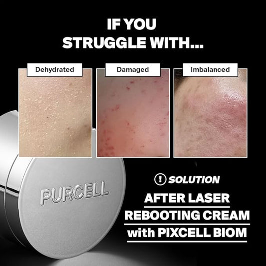 PIXCELL BIOM™ After Laser Rebooting Cream for Probiotic Barrier Recovery with Niacinamide, Panthenol, Suitable for Sensitive Skin, 1.69 fl oz(50ml)
