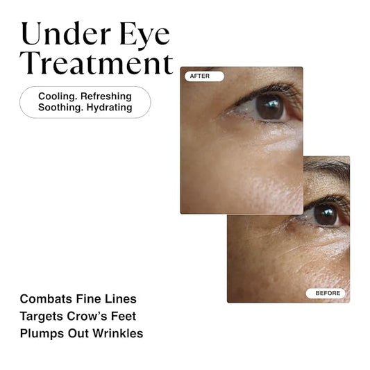 MATKAS Korean Retinol Renew Under Eye Cream for Face (0.5 Fl Oz) with Niacinamide and Shea Butter, Anti-aging Eye Cream for Dark Circles, Under Eye Brightener, Fade Wrinkles, Korean Skincare