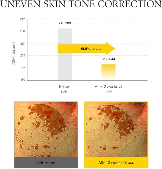 d'alba Piedmont White Truffle Vita Toning Serum Toner, Glass Skin with Double Vitamin Skincare, Face Moisturizer, (6.09 fl. oz)