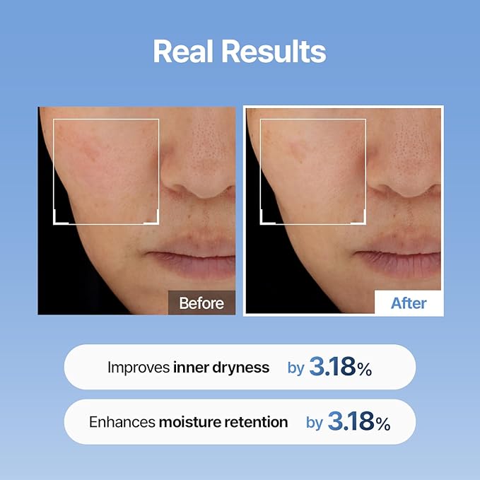 Meditherapy Hyaluronic Acid Serum XXL 150ml (5.07 fl.oz.) – Ultra Hydrating 333Serum for Glowing Skin, Face Moisturizer, Non-Sticky, Anti-Aging & Wrinkle Care, Korean Skin Care