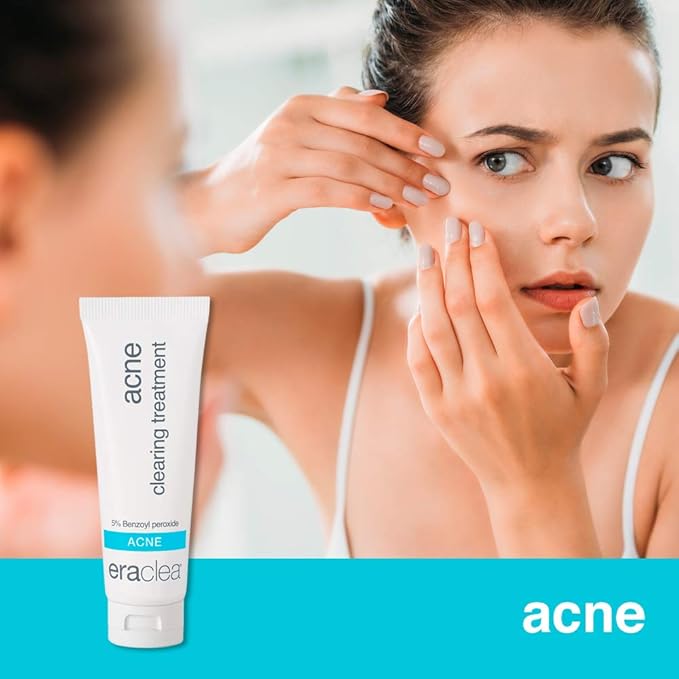 eraclea Acne Clearing Treatment, Acne Spot Treatment and Blackhead Remover with Salicylic Acid, Allantoin and Benzoyl Peroxide, Minimizes Pores, Clears Acne and Alleviates Redness (1 fl oz)