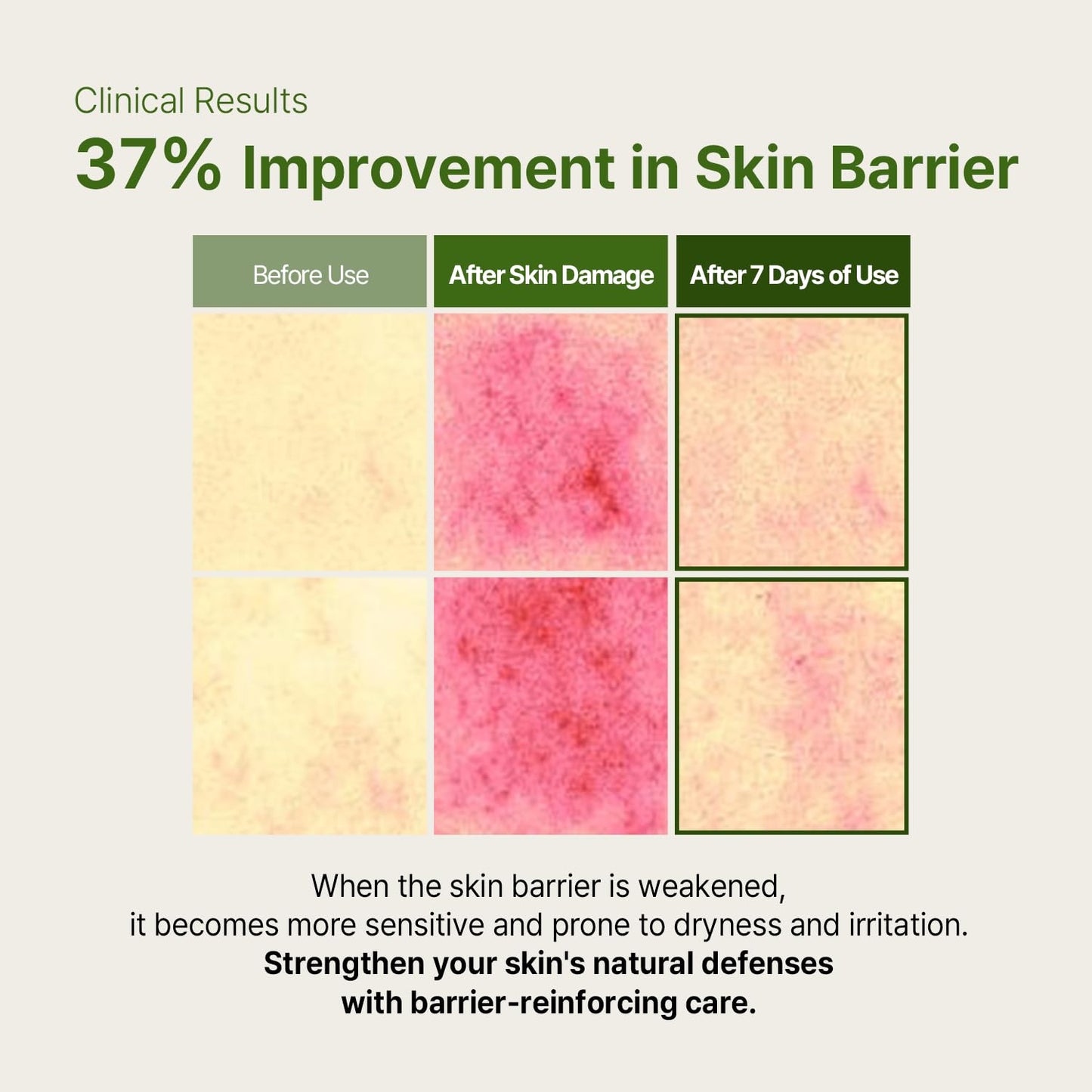 AVCA Cica Tea Tree Calming Serum 100ml(3.38 fl. oz) – Soothing for Redness & Sensitive, Blemish-Prone Skin, Oil Control K-Beauty