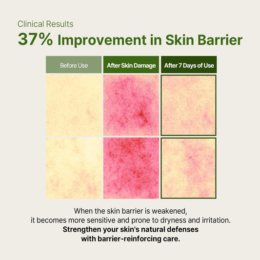 AVCA Cica Tea Tree Calming Serum 100ml(3.38 fl. oz) – Soothing for Redness & Sensitive, Blemish-Prone Skin, Oil Control K-Beauty