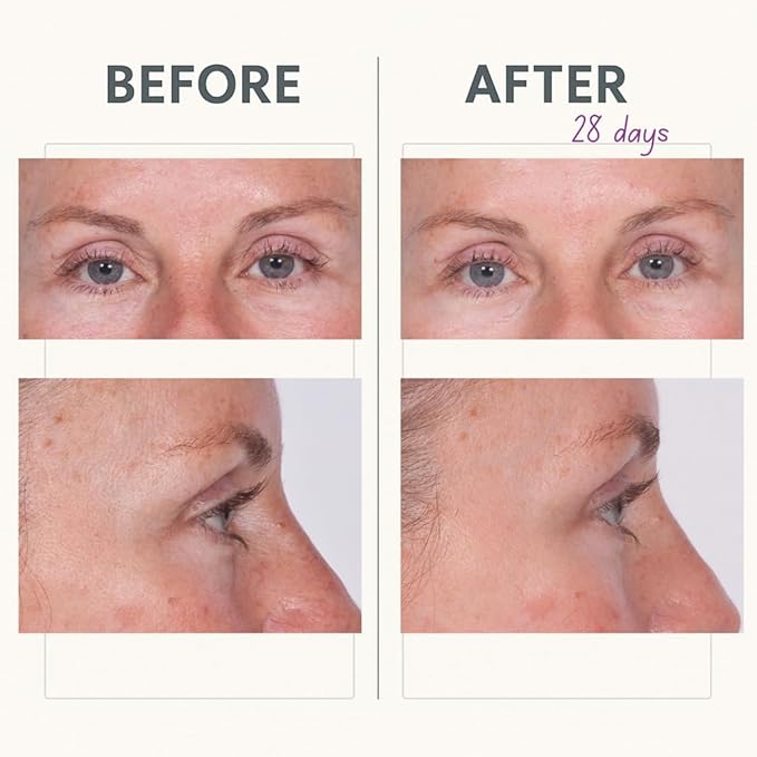 Serious Skincare Reverse Lift Tightening Eye Cream with Peptides, Hydrating Anti-Aging, Temporarily Lift Eyelids, Eyebrow, Under Eye Skin Firming Wrinkle Formula, Women, Men,1 Fl. Oz.