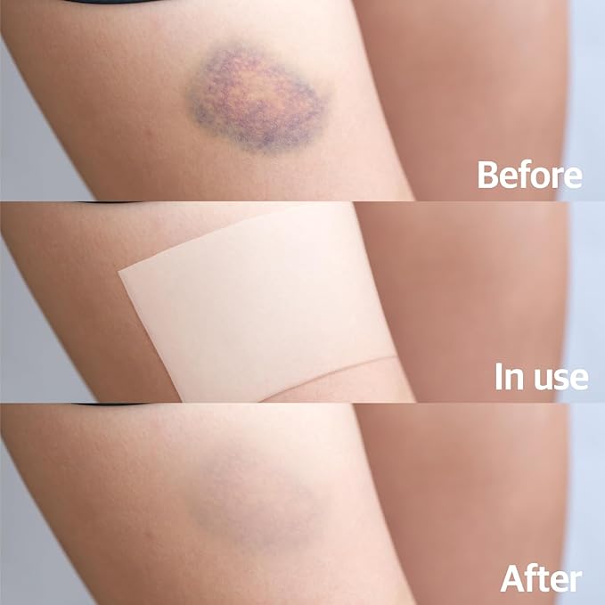 Arnica Hydrogel Pain Relief Patches | Natural Relief for Muscle, Joint, Bruises & Swelling | Flexible, Non-Greasy & Long-Lasting | Great for Back, Knee & Neck Pain (3.9"x4.7", 5, Count)