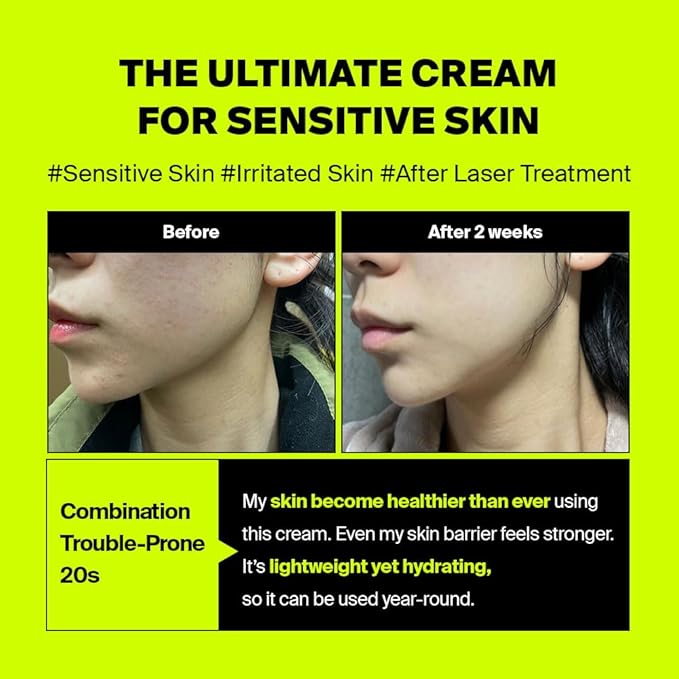 PIXCELL BIOM™ After Laser Rebooting Cream for Probiotic Barrier Recovery with Niacinamide, Panthenol, Suitable for Sensitive Skin, 1.69 fl oz(50ml)