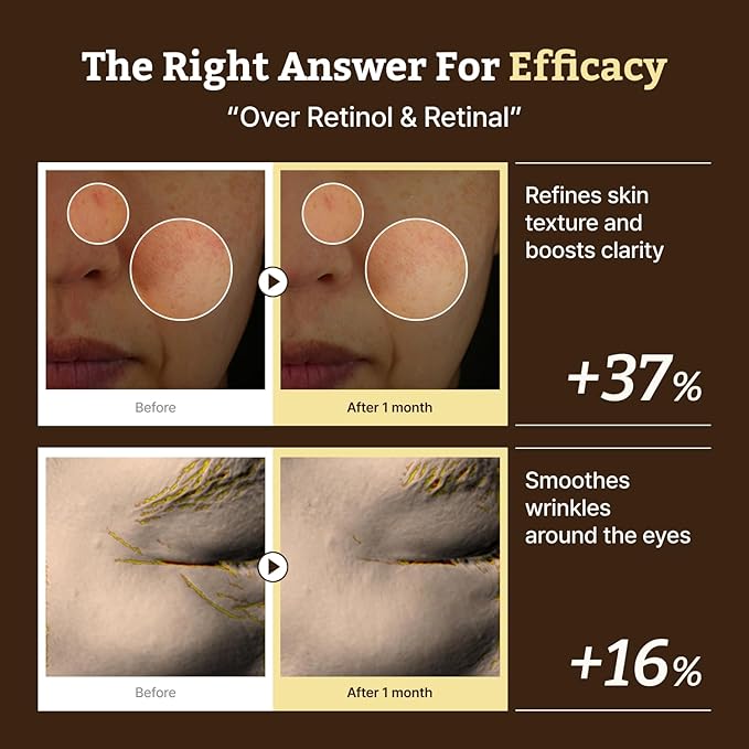 Dr. Reju-All Advanced Retino-Mela Serum – HPR Retinol Serum for Face – Anti-Aging, Pore Minimizer, Next-Gen Korean Skin care – Gentle & Beginner-Friendly – Niacinamide 10% & TXA 4% – 1 Fl Oz