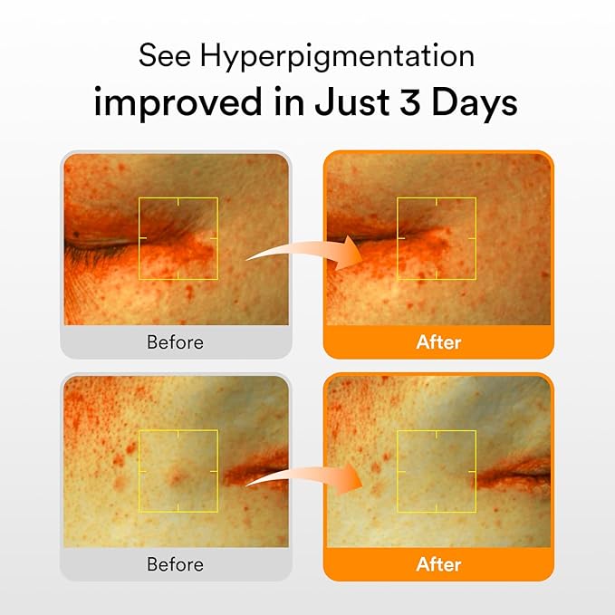 Abib Glutathiosome Dark Spot Serum Vita drop 1.69 fl.oz. | Korean Skincare, Dark Spot, Hyperpigmentation Treatment | Brightening Serum for Sensitive, Uneven Skin | Niacinamide, Viatmin C