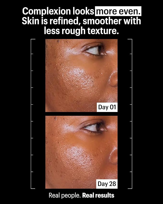 Allies of Skin Promise Keeper Blemish Sleeping Facial: Night Cream Moisturizer Treatment. Dioic + Mandelic + Lactic Acid, Manuka Honey, Rosehip Oil. Hydrates & Refines Skin 1.7 oz