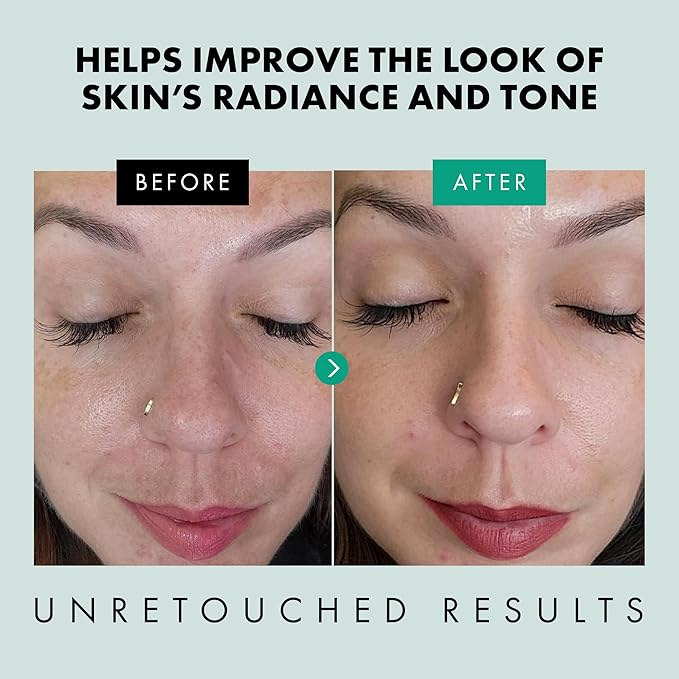 Eclat Skincare Clarifying Niacinamide Serum - 12% Niacinamide with Zinc PCA & Hyaluronic Acid - Hydrating & Soothing Formula - Facial Serum for Minimizing Pores - Stocking Stuffers for Women 1 Fl Oz