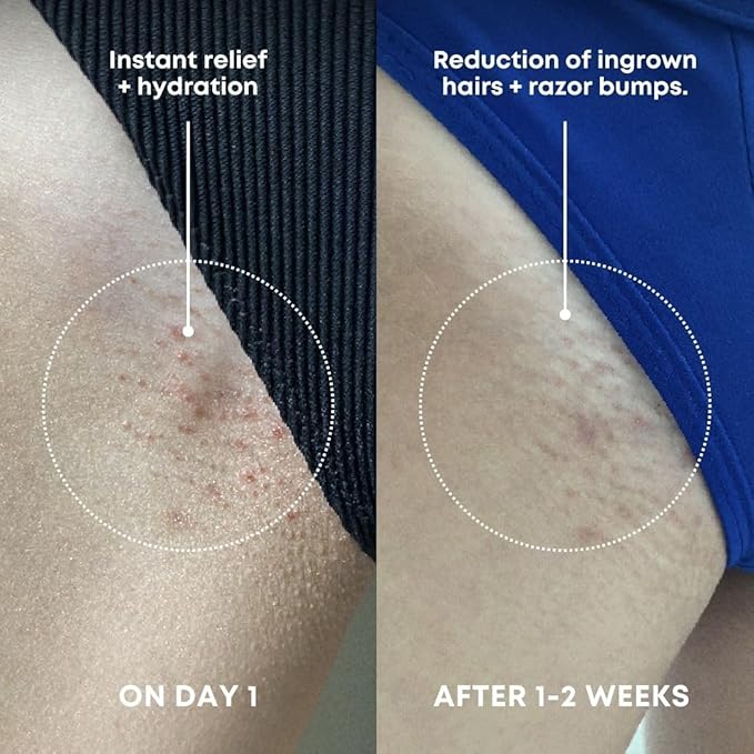 Bushbalm Ingrown Hair Exfoliating Scrub - Reduces Appearance of Ingrown Hairs and Underarm Bumps, Soothes Skin and Post Shave Redness - Nude, 236 ml