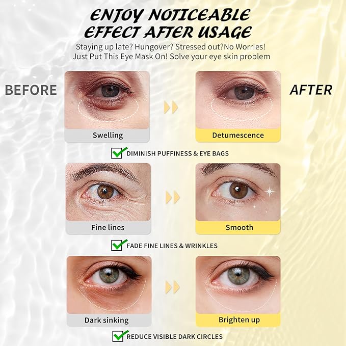 Under Eye Patches (8 Pairs), Aloe Vera Eye Masks for Dark Circles Puffy Eyes Undereye Bags, Collagen Eye Patches for Repair and Intensely Hydrate, Skin Care Gift for Her