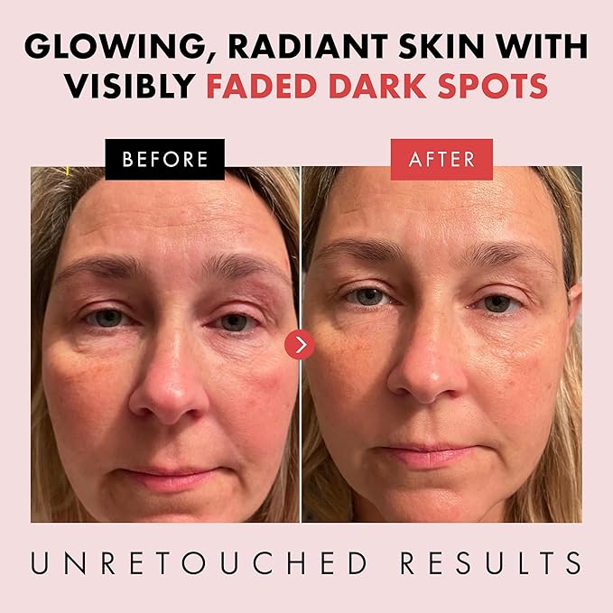 Eclat Skincare Renewing Retinol Serum for Face - Anti Aging Serum with Hyaluronic Acid & Aloe Vera – Hydrates and Improves Fine Lines, Wrinkles, & Dark Spots - Stocking Stuffers for Women 1 Fl Oz