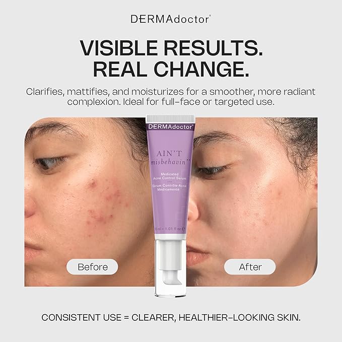 DERMAdoctor Ain't Misbehavin' Dermatologist Formulated Salicylic Acid Acne Control Serum, Acne Spot Treatment for Blemish Control and Cystic Acne breakouts with Tea Tree - 1 oz