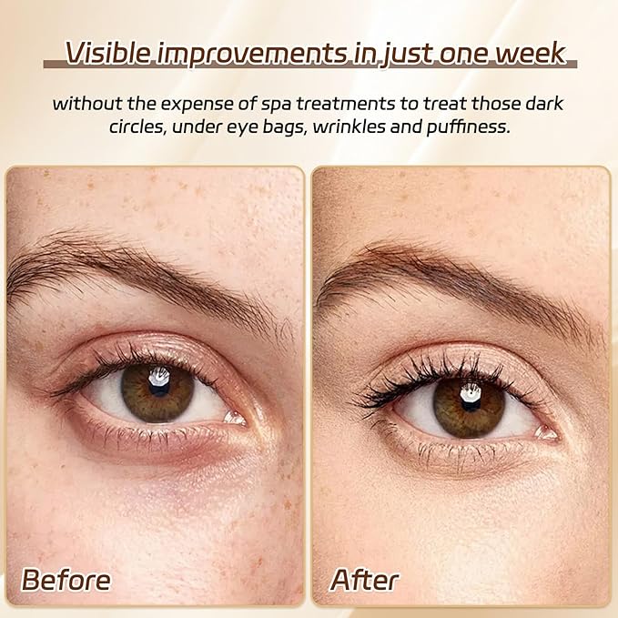 50 Pairs Under Eye Patches,24k Gold Gold Eye Mask,Eye Mask with Collagen,Eye Gel Pads for Puffy Eyes and Dark Circles,Reduces Wrinkles RevitalisesYour Skin, Skincare Treatment for Women Men