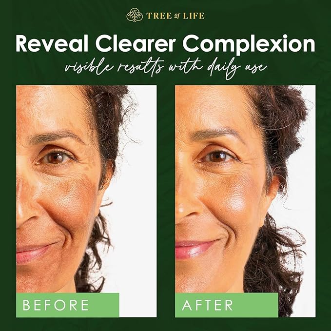 Tree of Life Beauty Niacinamide Vitamin B3 Serum, Hydrating Face Oil for Dark and Age Spots, Tightens Pores, Facial Serums for Sensitive Skin with Hyaluronic Acid and Vitamin E, 2 Fl Oz (Pack of 2)