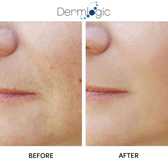 Anti Aging Resurfacing Peel Pads - Contains Salicylic, Glycolic, & Lactic for Face, Neck & Décolleté. Exfoliates, Brightens, Tones the Skin & Reduces Dark Spot, Fine Lines & Wrinkles for Radiant Glow.